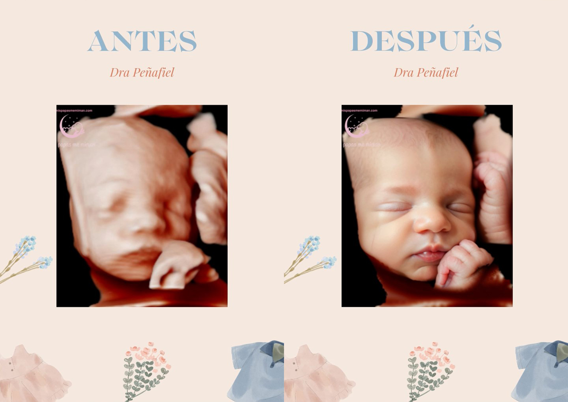 Ecograf�a 5D Hiperrealista